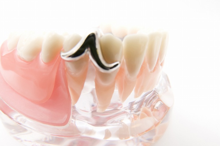 入れ歯に使用する素材の違い
