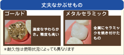 セラミック